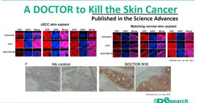 A DOCTOR to Kill the Skin Cancer